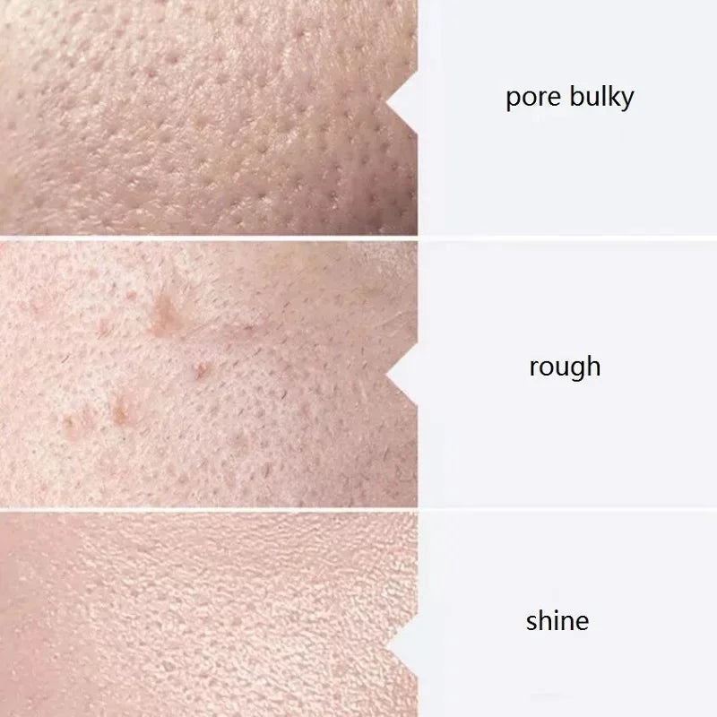 Facial Skincare Face Serum AS1 SA2 AO3 Aqua Peel Solution For Facial Machine Skin Deep Cleaning 400ml Kit of 3 Serums CB DROPSHIPPING