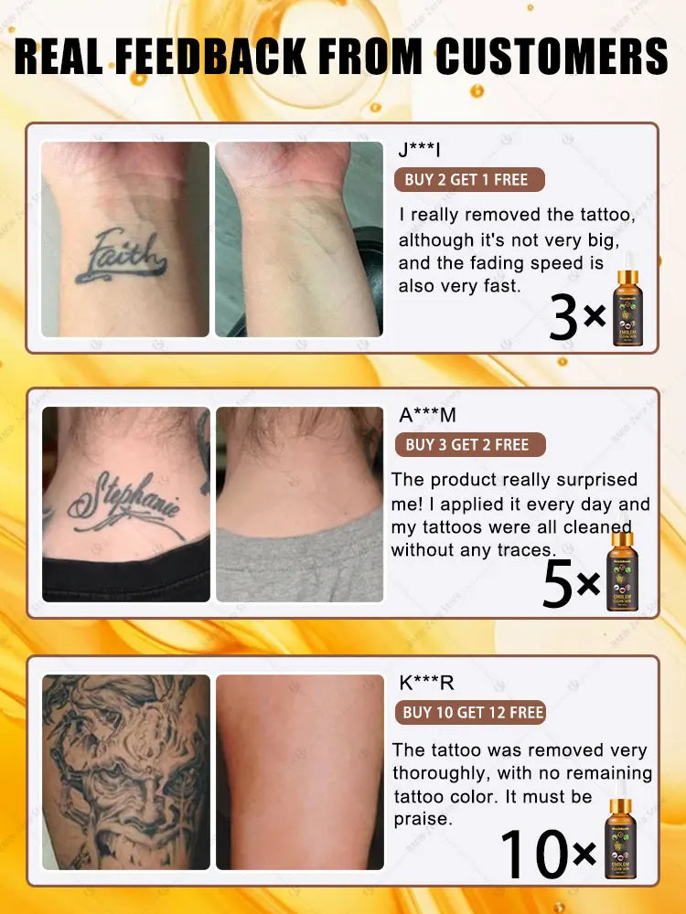 2026 Hot sale For the removal of colored permanent makeup tattoos,pattern tattoo removal CB DROPSHIPPING