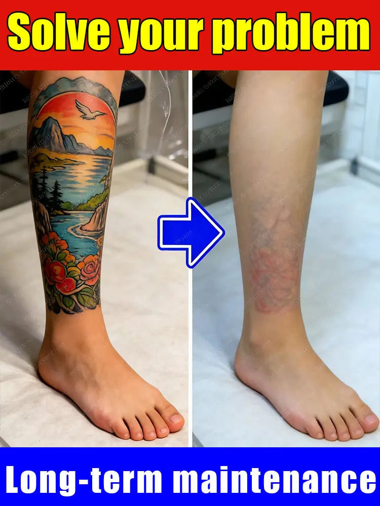 2026 Hot sale For the removal of colored permanent makeup tattoos,pattern tattoo removal CB DROPSHIPPING